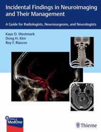 Incidental Findings in Neuroimaging and Their Management