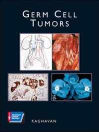 GERM CELL TUMORS