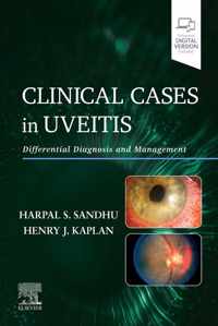 Clinical Cases in Uveitis