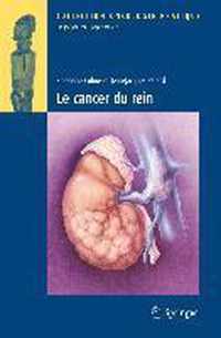 Le Cancer Du Rein