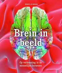 Brein in beeld