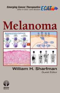 Melanoma