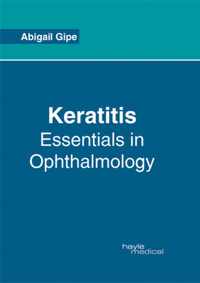 Keratitis