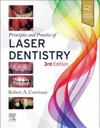 Principles and Practice of Laser Dentistry