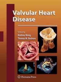 Valvular Heart Disease