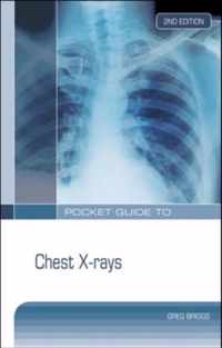 Pocket Guide to Chest X-Rays