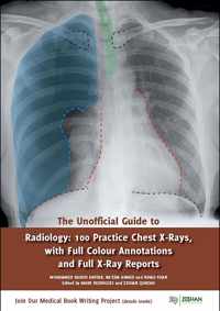 The Unofficial Guide to Radiology: 100 Practice Chest X Rays with Full Colour Annotations and Full X Ray Reports