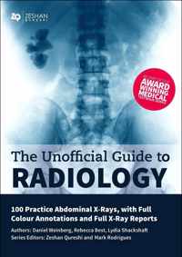 Unofficial Guide to Radiology: 100 Practice Abdominal X Rays with Full Colour Annotations and Full X Ray Reports