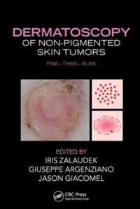 Dermatoscopy of Non-Pigmented Skin Tumors