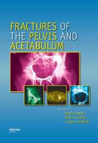 Fractures of the Pelvis and Acetabulum