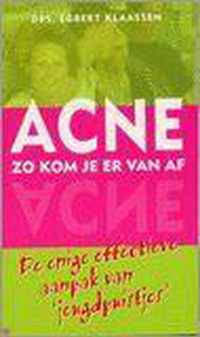 Acne Zo Kom Je Er Van Af